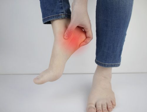 Fasciite plantaire : quelles solutions efficaces en physiothérapie ?